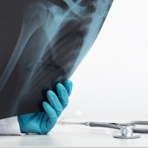 Dr HS PRETORIUS BSc MB ChB MMed (Orth)(Stell) Specialist Orthopaedic Upper Limb & Reconstructive Surgeon