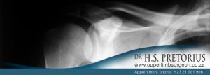 Dr Pretorius Upper Limb Surgeon - shoulder
